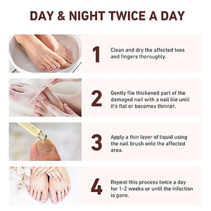 7 días de crecimiento y fortalecimiento de uñas suero 0.7 fl oz solución suavizante de onicomicosis aceite de tratamiento de uñas para uñas descoloridas y dañadas